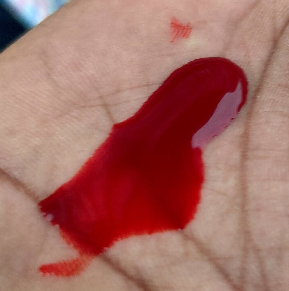 Cyanide Poisoning In Cattle