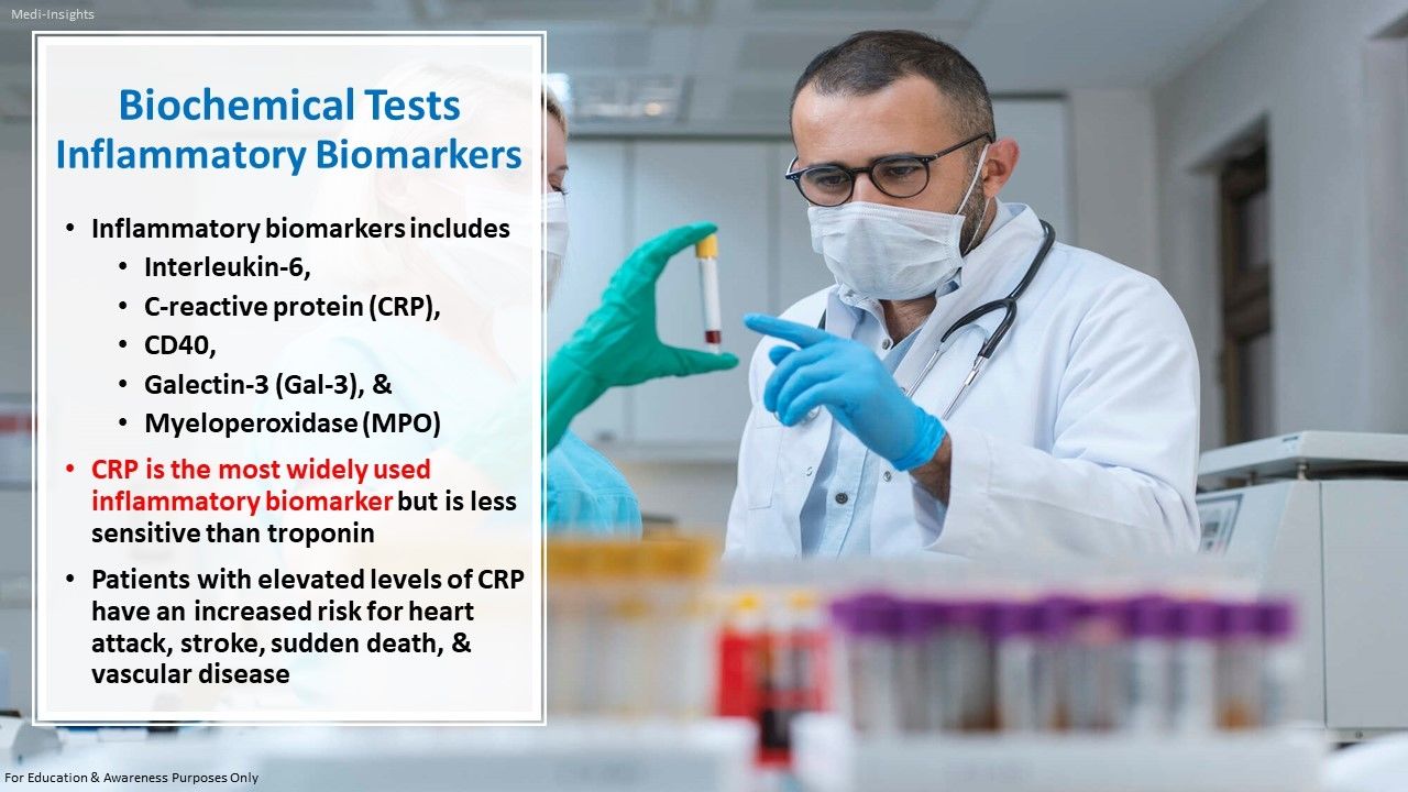 Assessment of Ischaemic Heart Disease Cardoivascular Tests Procedures