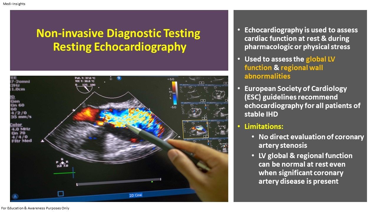 Assessment of Ischaemic Heart Disease Cardoivascular Tests Procedures