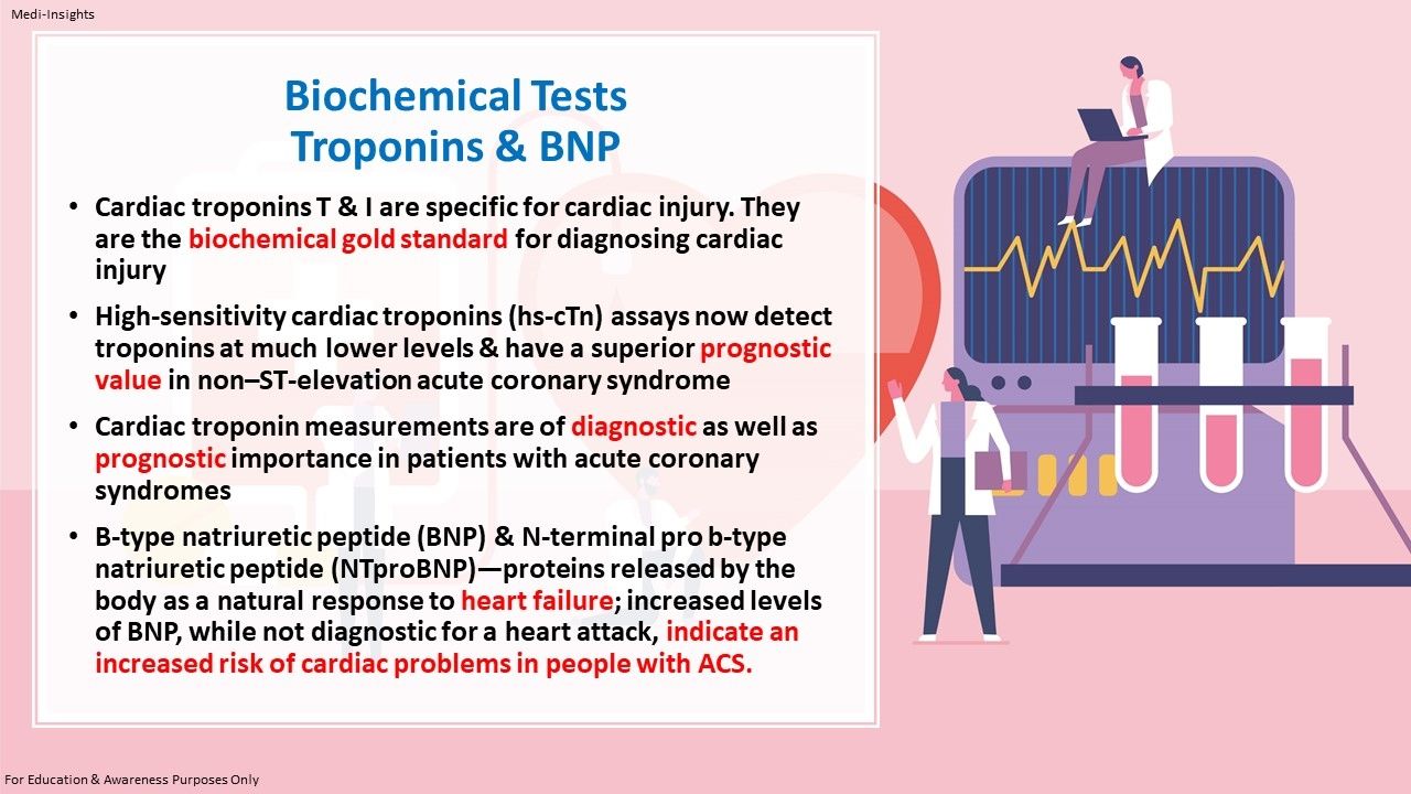 Assessment of Ischaemic Heart Disease Cardoivascular Tests Procedures