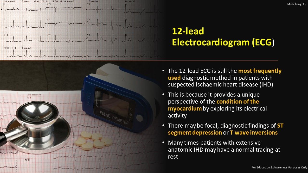 Assessment of Ischaemic Heart Disease Cardoivascular Tests Procedures