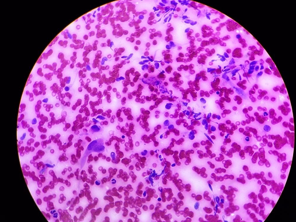 FINE NEEDLE ASPIRATION CYTOLOGY
