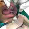 Dr. Nikita S Munde