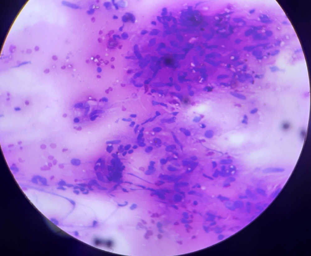 FINE NEEDLE ASPIRATION CYTOLOGY