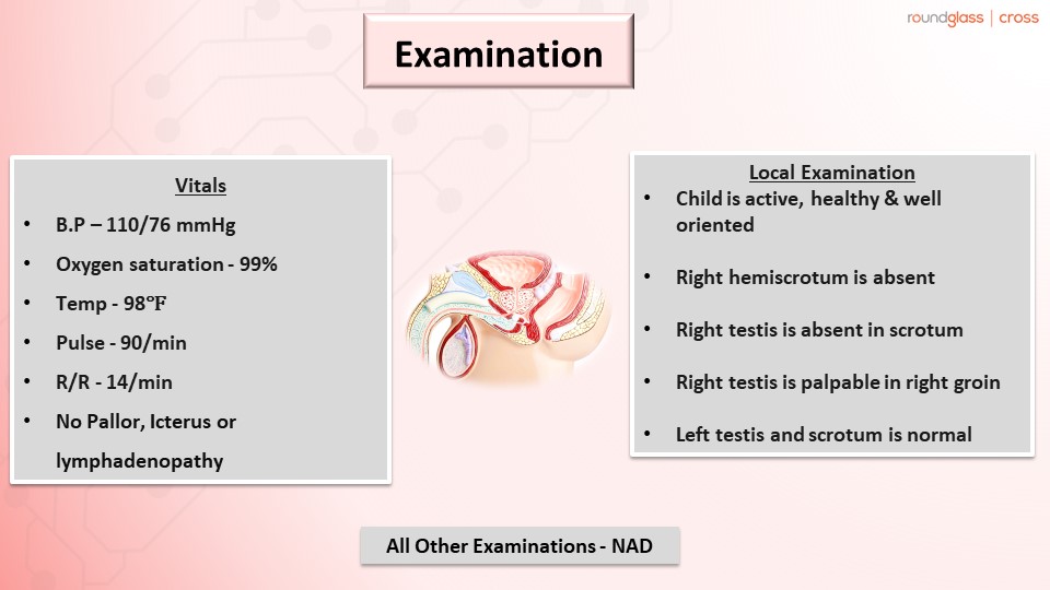 A clinical case of Undescended Testes