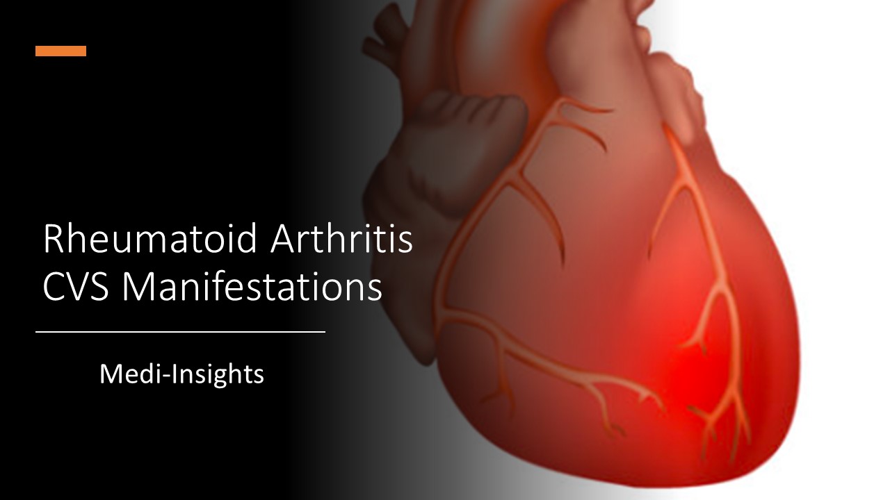 Heart in Rheumatoid Arthritis