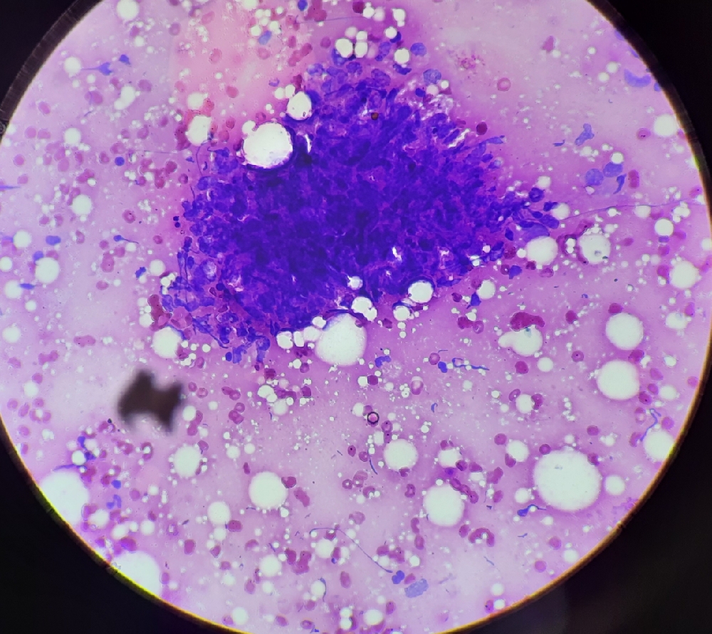 FINE NEEDLE ASPIRATION CYTOLOGY