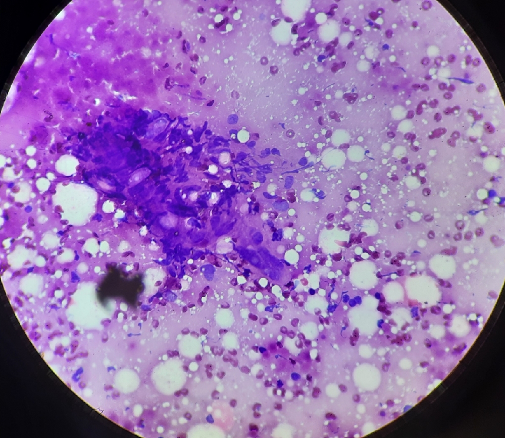 FINE NEEDLE ASPIRATION CYTOLOGY