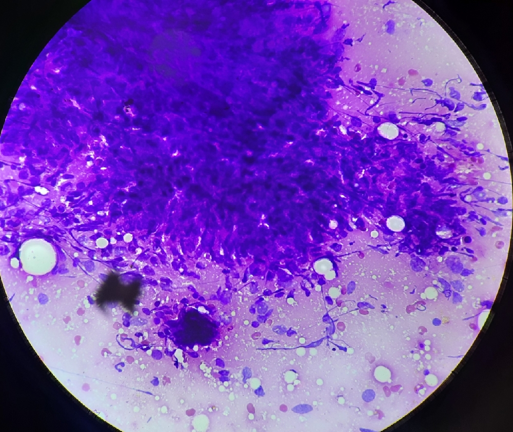 FINE NEEDLE ASPIRATION CYTOLOGY