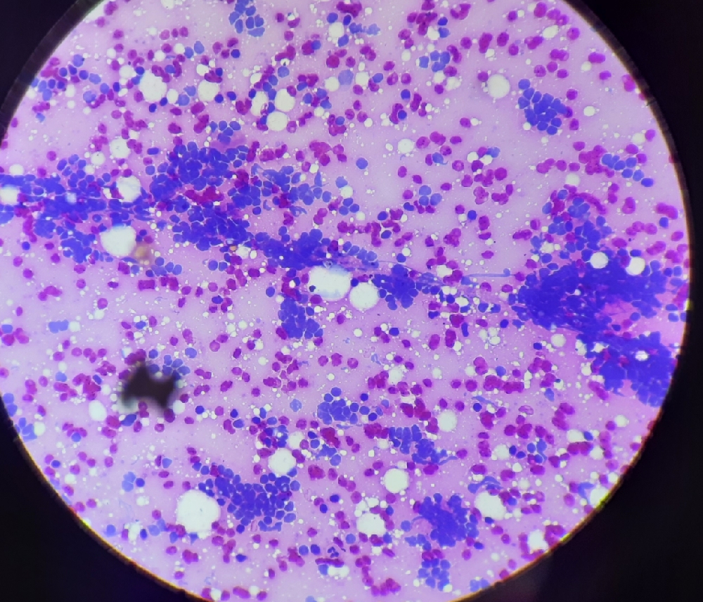 FINE NEEDLE ASPIRATION CYTOLOGY