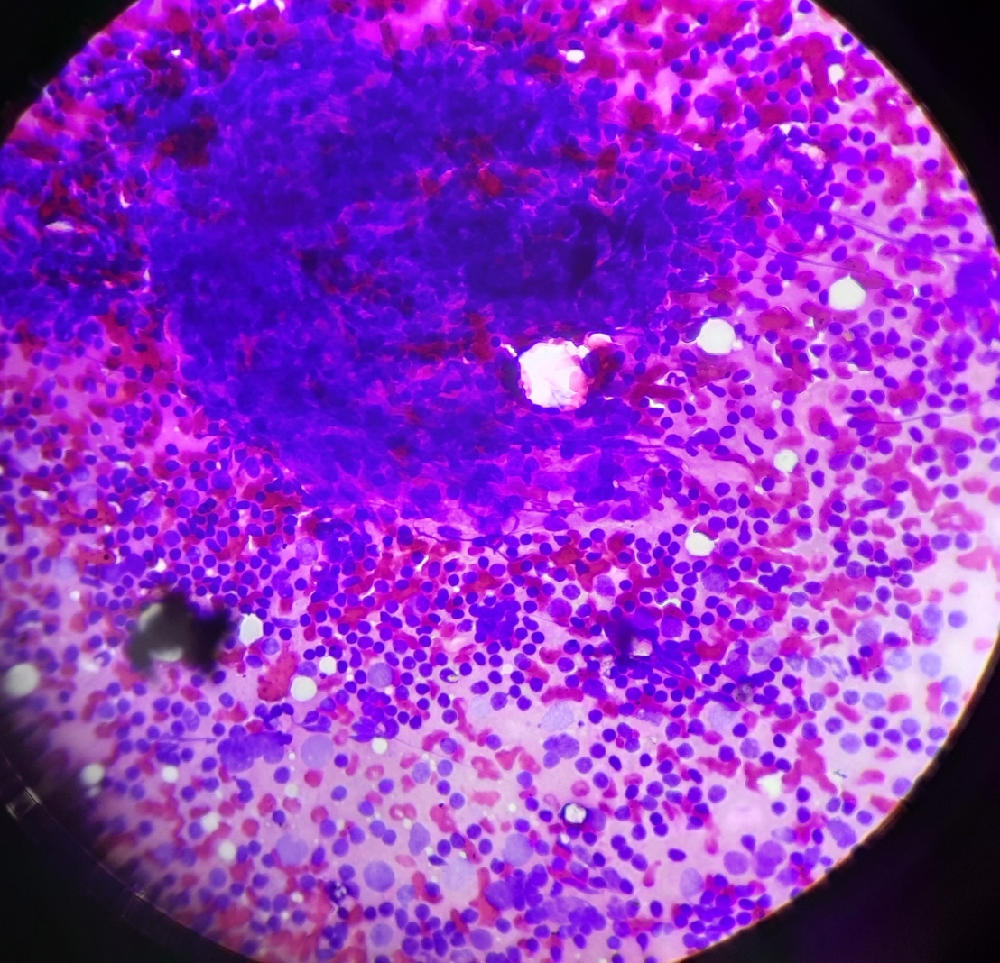 FINE NEEDLE ASPIRATION CYTOLOGY