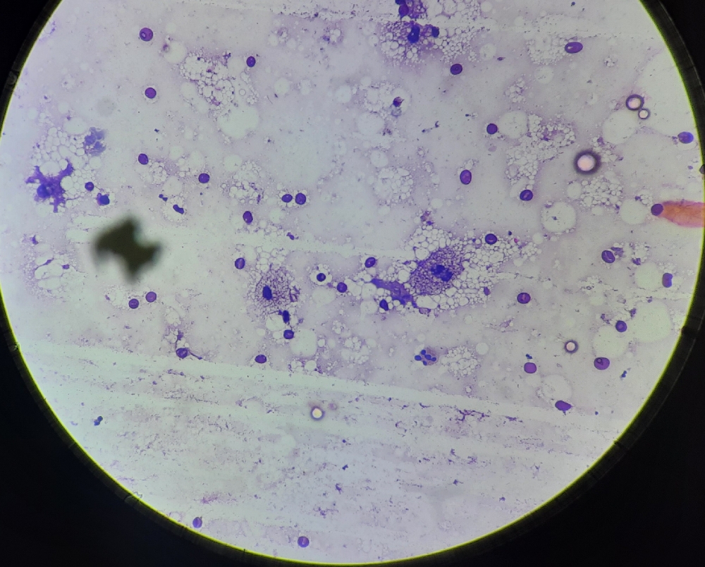 FINE NEEDLE ASPIRATION CYTOLOGY