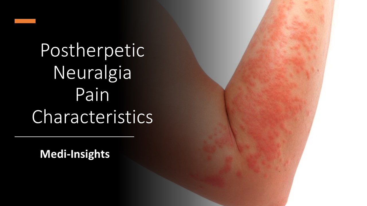 Postherpetic Neuralgia