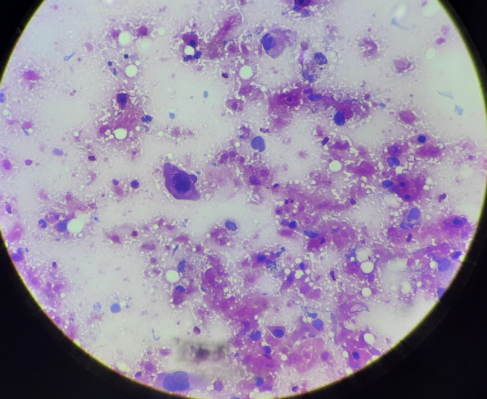 FINE NEEDLE ASPIRATION CYTOLOGY