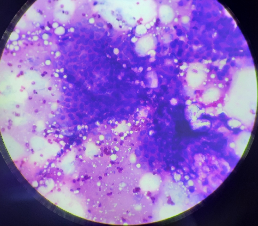 FINE NEEDLE ASPIRATION CYTOLOGY