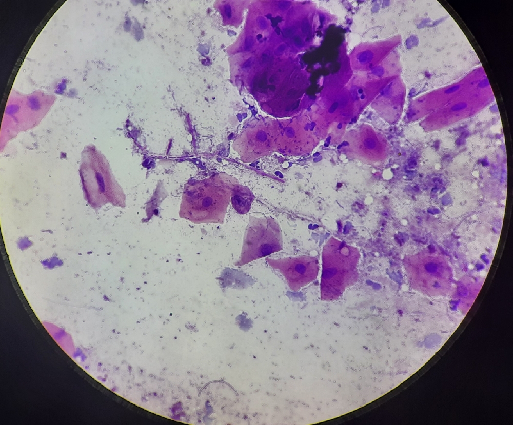SCRAPE CYTOLOGY