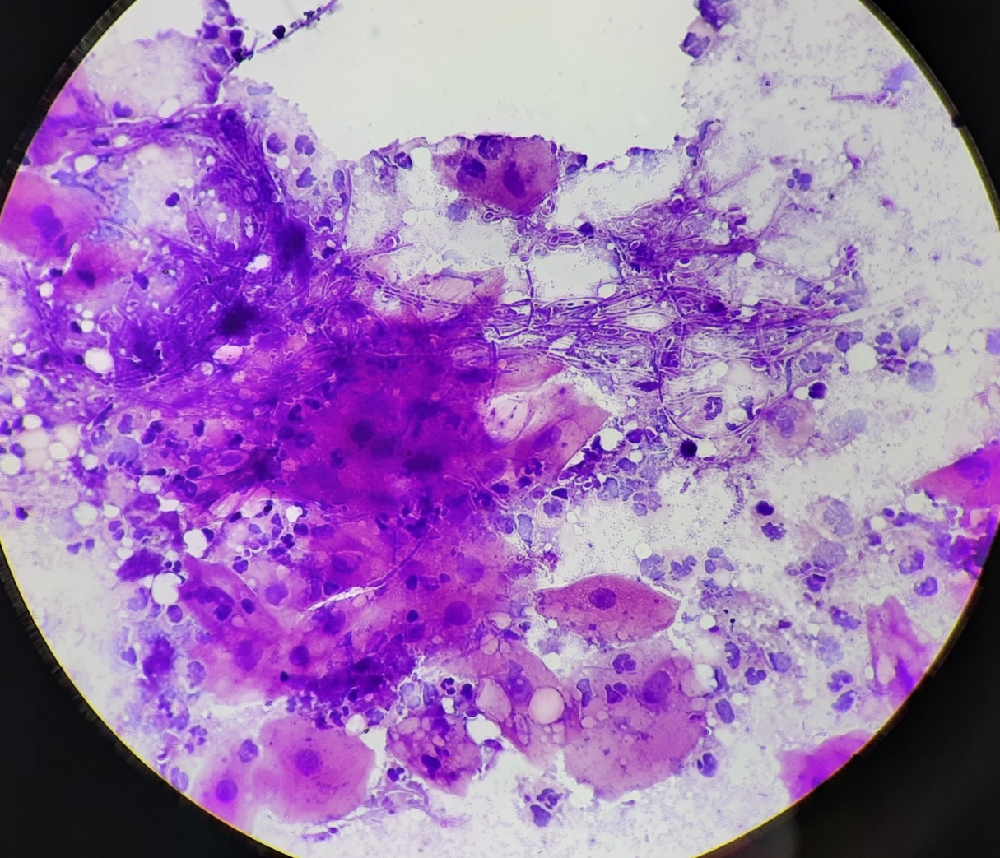 SCRAPE CYTOLOGY