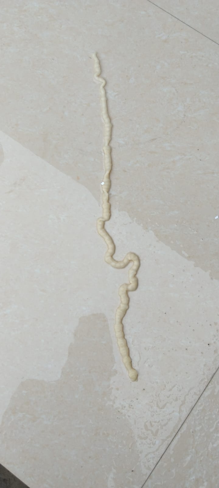 Tapeworm in stool