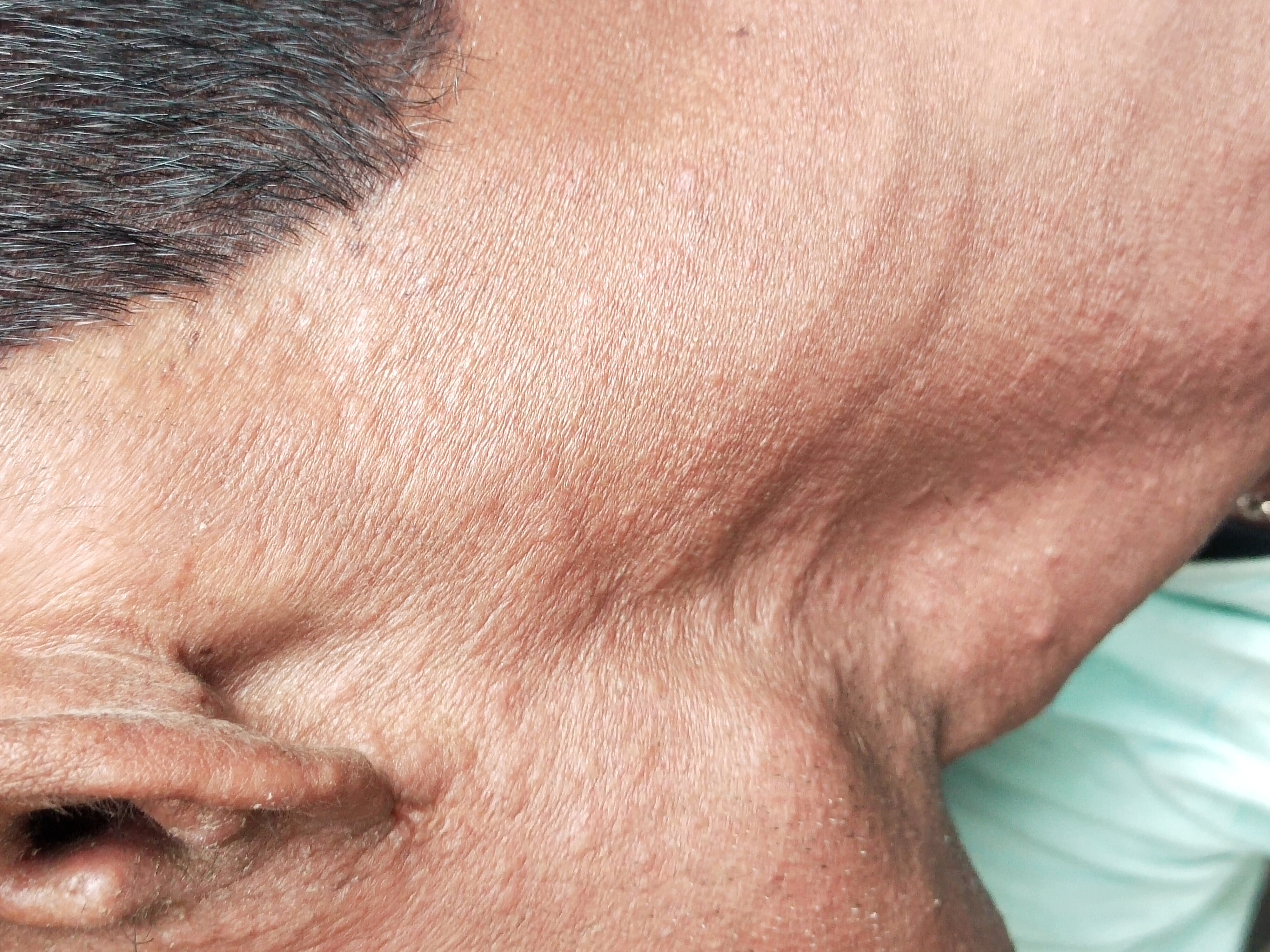 Dr. Kaluram Meena's profile on Curofy
